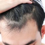 Close-Up Of Man With Receding Hairline Against White Background