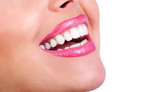 porcelain veneers cost