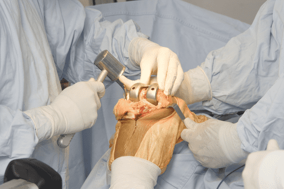 orthopedic surgery